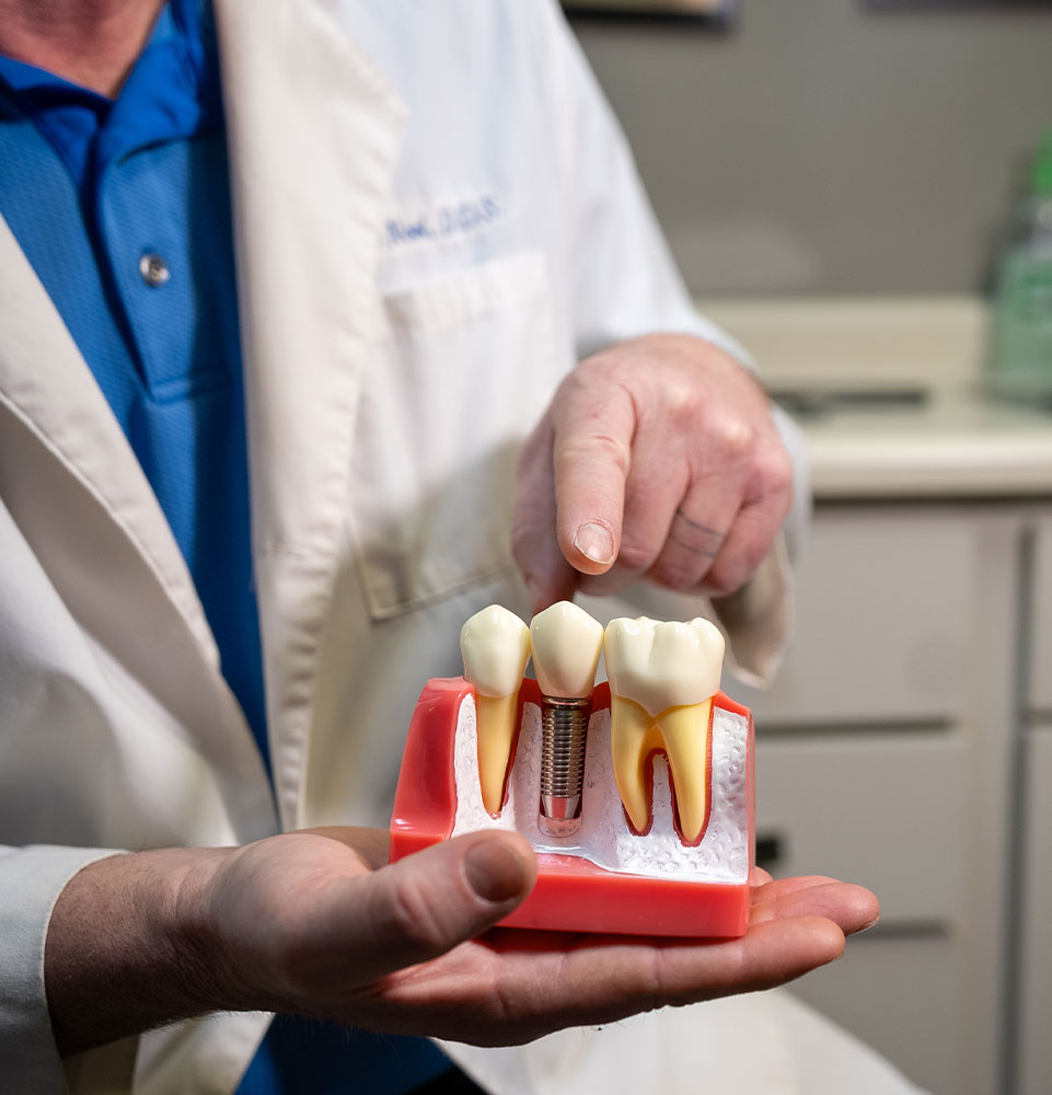 dr burke pointing after dental implant model