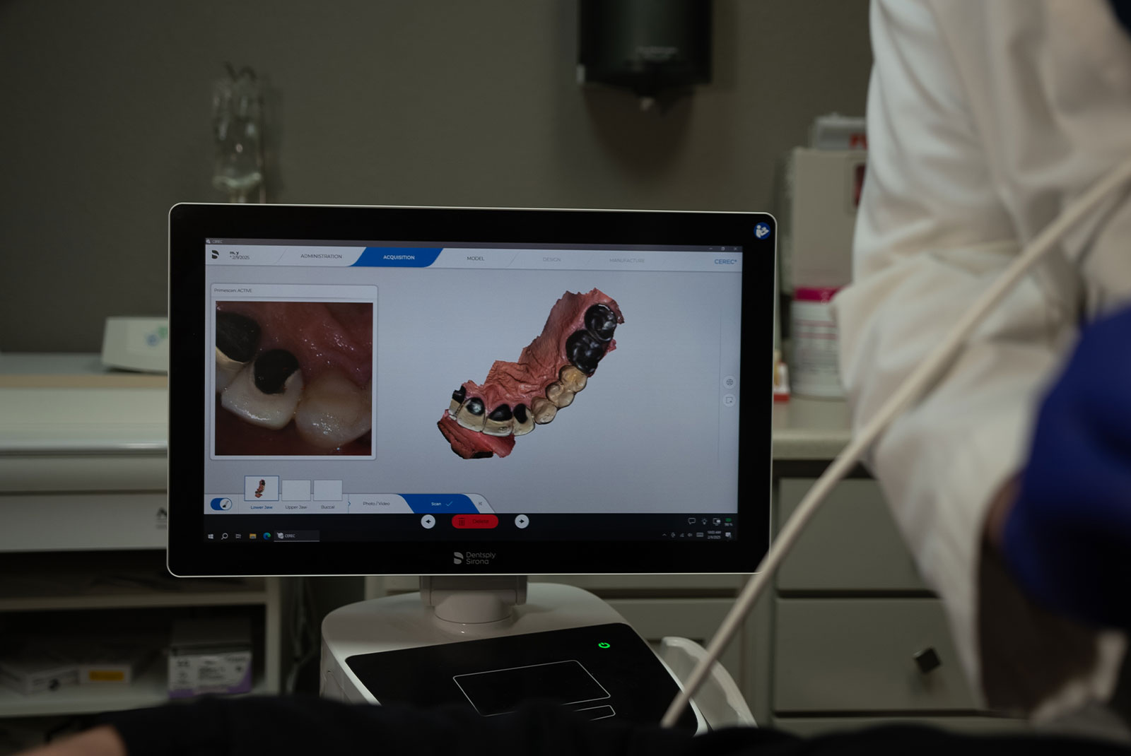 dsd scan for full mouth recon