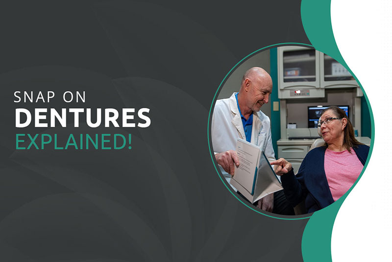 mv3 snap on dentures explained modified