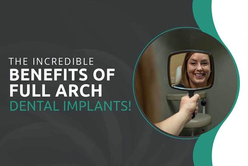 mv4 benefits modified