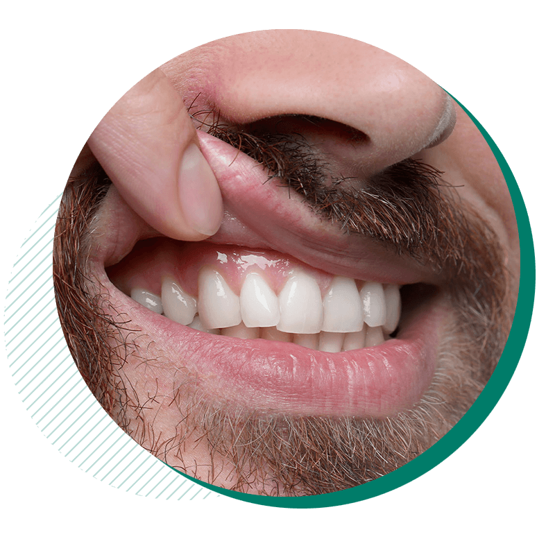 warning signs of gum disease